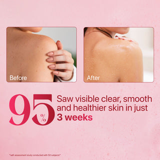 ⁠Value Pack: 1% Salicylic Acid and Vitamin C Body Wash Free Loofah)